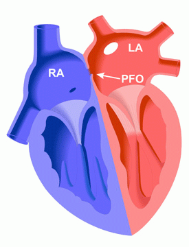 pfo3