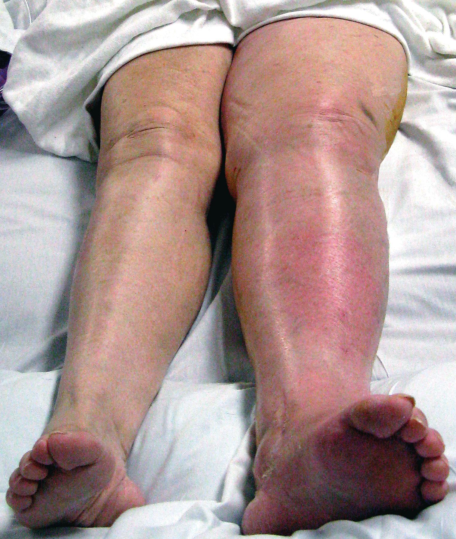 Fig-23-1