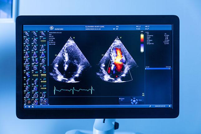 3D-Echocardiography-3