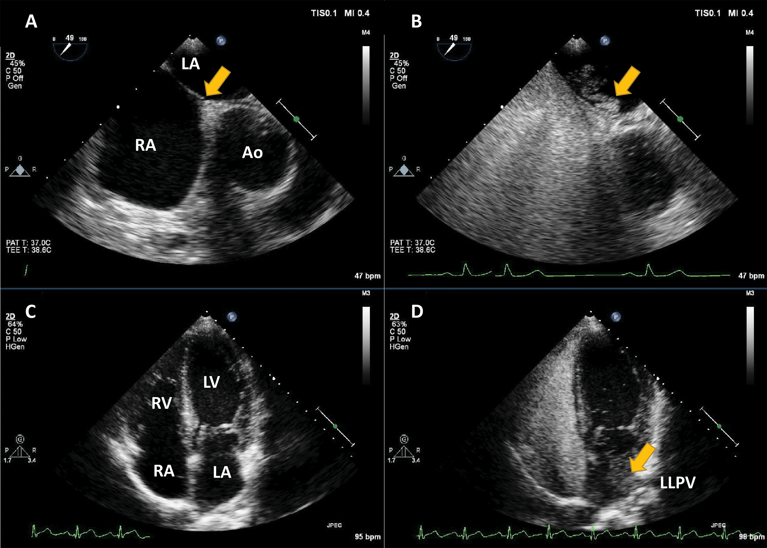 fig1