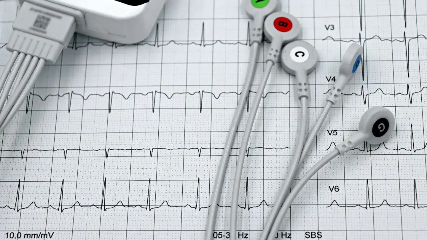 screening_12-lead-ecg_hero-image