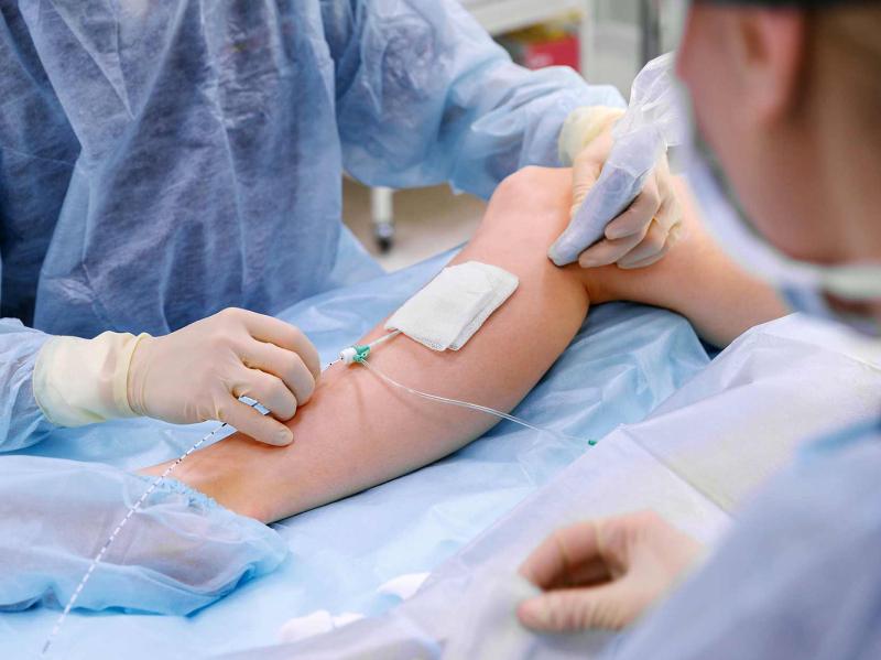 Endovenous-Laser-EVLA-Treatment-ec89d6a78ea0c5cfe416c29f70303e28