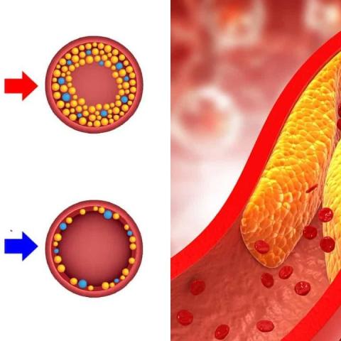 LDL و HDL چیست؟ تفاوت کلسترول خوب و بد