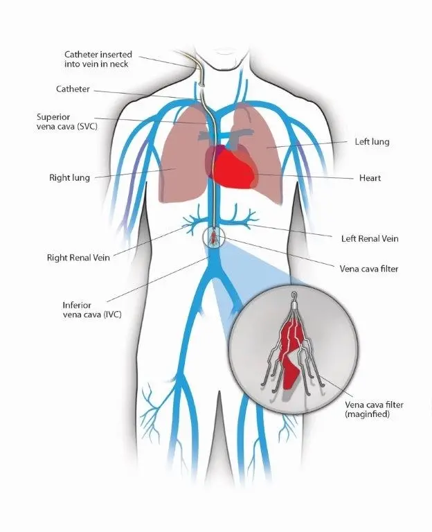 Patient-Guide5retrieveFINAL2