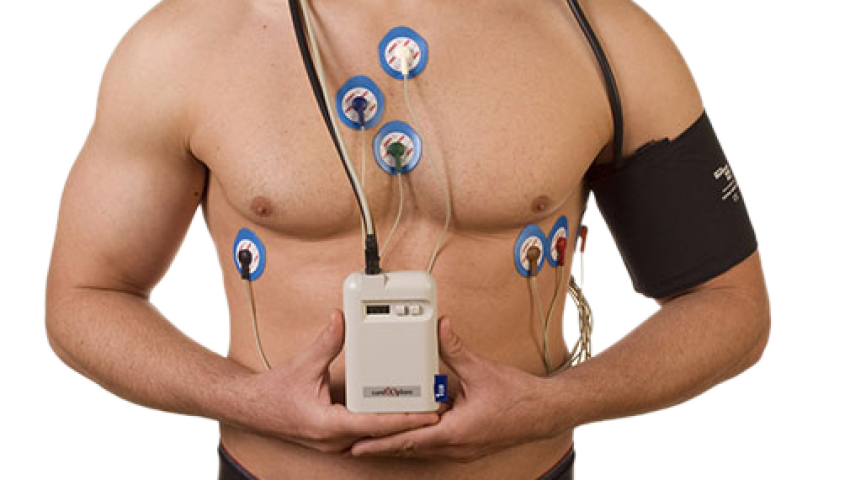 هولتر 24 ساعته نوارقلب (Holter Monitoring)