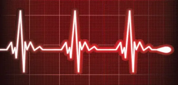 ecg