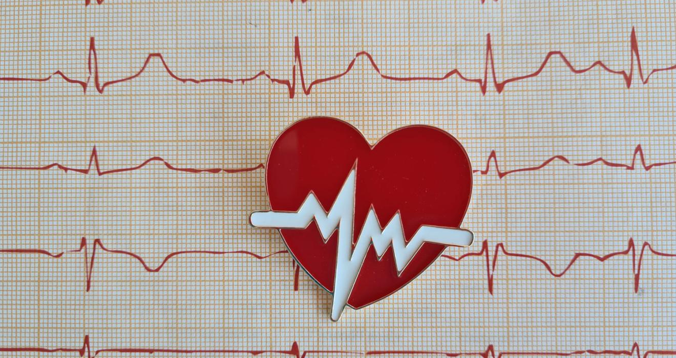 ekg-1320x700