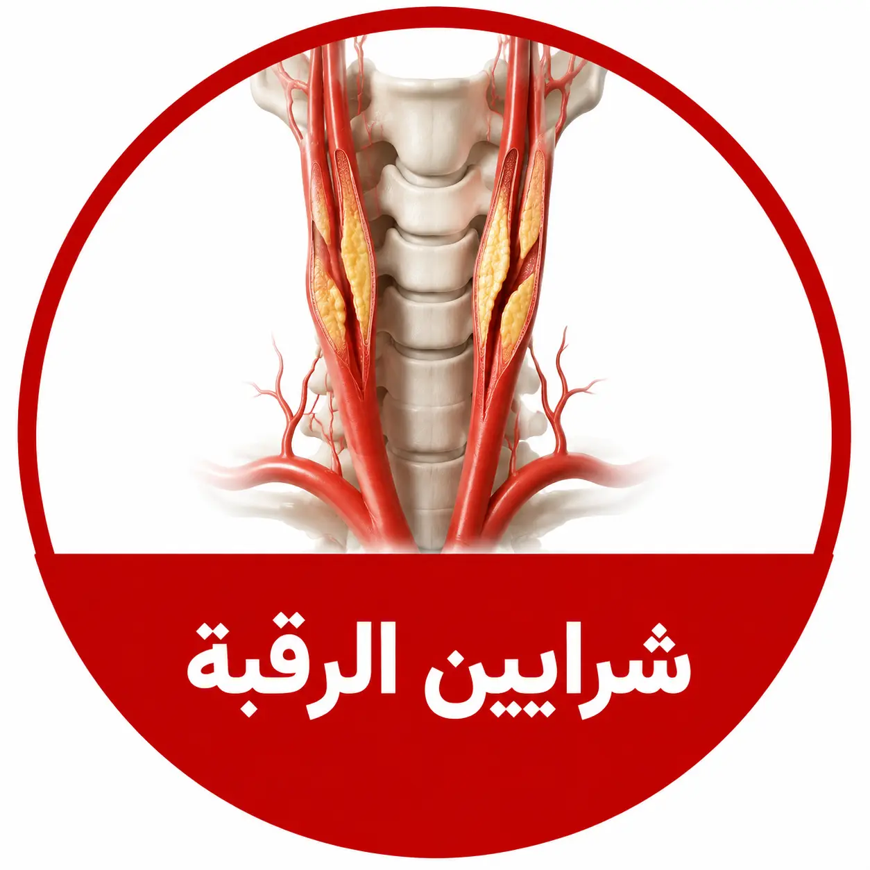 شرايين الرقبة